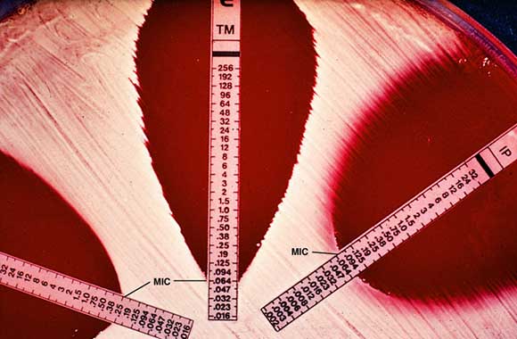 E (Epsilometer) Test- Principle, Purpose, Procedure, Result Interpretation with Precaution, Advantages and Disadvantages