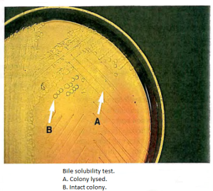 Plate method of Bile Solubility Test