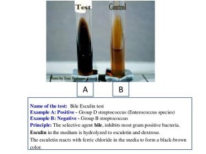 Bile Esculin Test