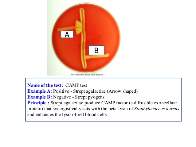 CAMP test showing half-moon shaped zone of complete hemolysis on a