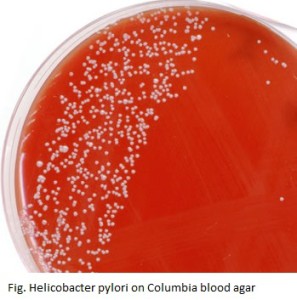 Helicobacter pylori on columbia blood agar