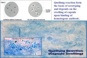 Quellung Reaction for Pneumococci