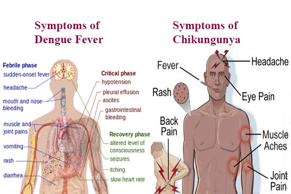 Chikungunya symptoms deals