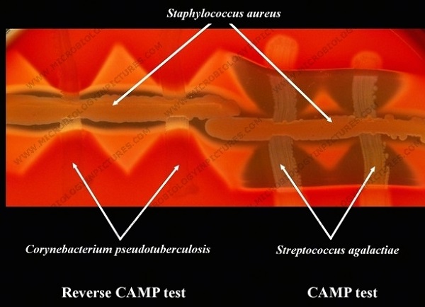 Reverse camp test