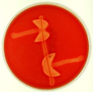 Reverse CAMP test for the identification of Clostridium perfringens