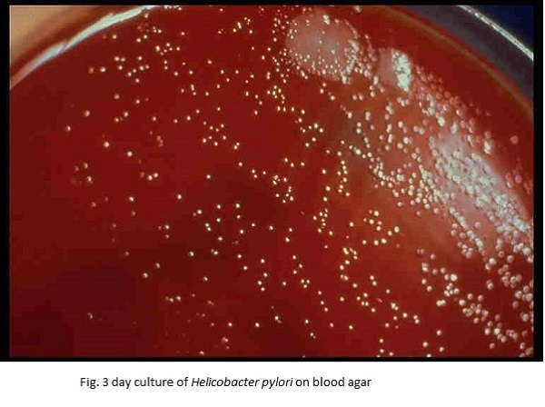 3 day culture of Helicobacter pylori on blood agar