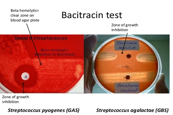 Bacitracin test