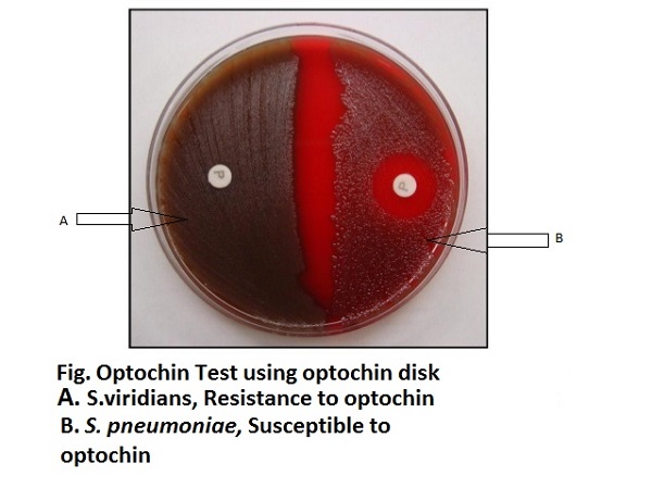 Result Interpretation of Optochin test