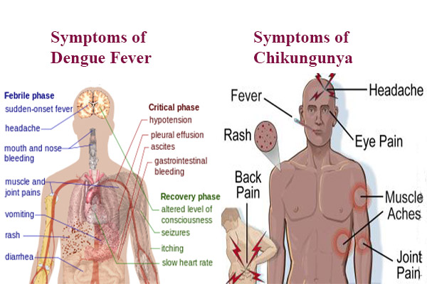 Dengue vs Chikungunya